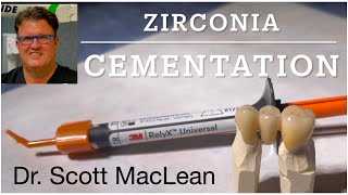 Zirconia Cementation with RelyX Universal Cement  Dr Scott MacLean  Dentist [upl. by Alasteir]