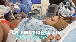 THE LIVE BIRTH OF OUR SECOND SET OF TWINS  Real Raw amp Emotional Doctor Turns Breech Baby in Womb [upl. by Arraek]