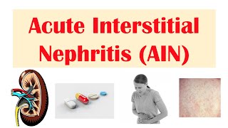 Nephrotic Syndrome  Types and pathology histology [upl. by Kenison487]