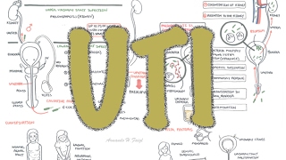 Nephrotic vs Nephritic Syndrome Proteinuria Hematuria Casts [upl. by Anidan22]