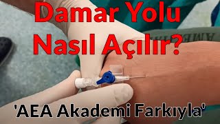 Damar Yolu Nasıl Açılır [upl. by Bonnie805]