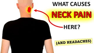 What Causes Upper Neck Pain And Headaches [upl. by Adaline975]