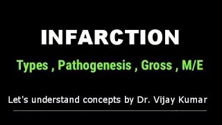 Infarction Pathology  Infarction Types  Infarction Morphology  Pathology Lectures [upl. by Gmur42]