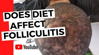 Folliculitis  Does diet affect folliculitis [upl. by Nebeur]