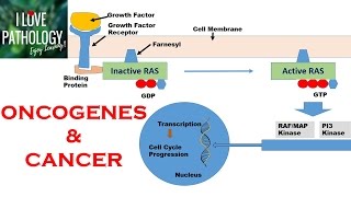 NEOPLASIA 2 HALLMARKS OF CANCER  Protooncogenes Oncogenes amp Oncoproteins [upl. by Erda155]