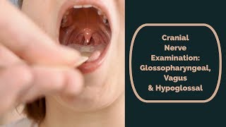 Cranial Nerve Examination CN 9 10 amp 12 glossopharyngeal vagus amp hypoglossal [upl. by Abla]