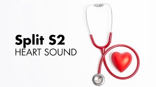 Heart Sounds Collection  EMTprepcom [upl. by Notsirk]