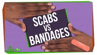 Whats Better for Wounds Scabs or Bandages [upl. by Naz]