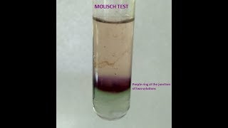 Molisch Testa group test for Carbohydrates [upl. by Aveline]