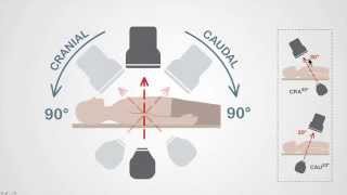 Mastering Coronary Angiography Image Intensifier amp Carm Fundamentals [upl. by Etam]