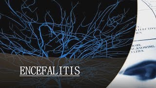 ENCEFALITIS [upl. by Hume597]