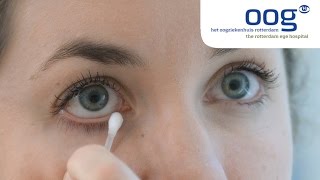 Reinigen en masseren van het ooglid bij blepharitis [upl. by Cuthbert81]