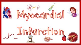 Myocardial InfarctionHeart Attack Causes Pathogenesis Signs amp Symptoms Diagnosis amp Treatment [upl. by Essilevi]