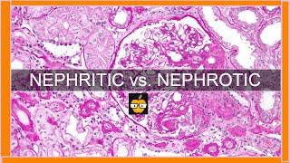 Nephritic vs Nephrotic Syndromes [upl. by Dari927]