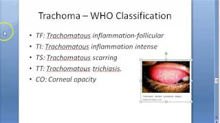 Ophthalmology 076 d Trachoma WHO Classification FISTO [upl. by Enwad]