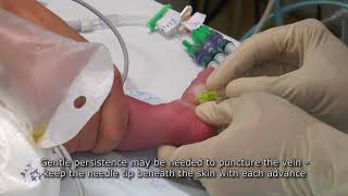 Paediatric Anaesthetics Chapter 7  Long saphenous IV neonate 1 [upl. by Adne]