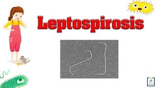 Leptospira IgM and IgG test [upl. by Hebe]