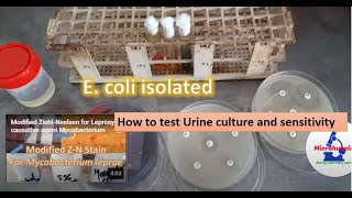 How to test urine culture and sensitivity [upl. by Eninaej]