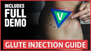 All You Need To Know About Joint Injections [upl. by Vilma152]