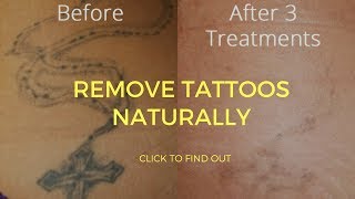 How To Remove Tattoos Naturally [upl. by Melodee]