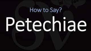 How to Pronounce Petechiae CORRECTLY Meaning amp Pronunciation [upl. by Giverin858]