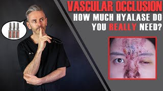 Vascular Occlusion How Many Vials Of Hyalase Do You REALLY Need Aesthetics Mastery Show [upl. by Borman]