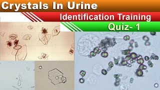 Crystals In Urine Identification Training Quiz  Part 15 [upl. by Pages623]