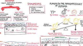 Asthma  signs and symptoms pathophysiology [upl. by Colbert]