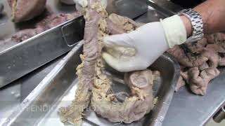 Anatomy Dissection of Large amp Small Intestine [upl. by Seldan912]