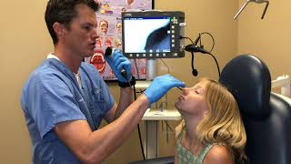 Pediatric Nasal Endoscopy Pediatric [upl. by Lizette]