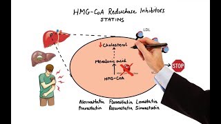 The Dangers of Statins Part 1 Series Overview [upl. by Haizek69]