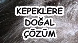 KEPEKLERE DOĞAL ÇÖZÜM [upl. by Neik]