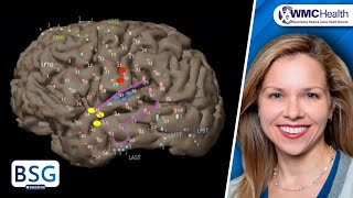 Temporal Lobe Epilepsy Seminar 1 Overview [upl. by Euqor70]