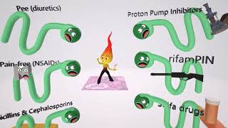 Acute Nephritic Syndrome Fundamentals – Nephrotic Syndrome  Lecturio [upl. by Aibat884]