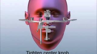 How to Transfer the Whip Mix Facebow from Patient to Articulator [upl. by Kathrine]