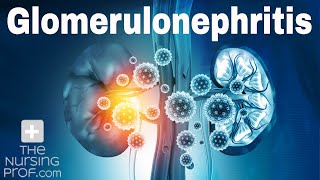 Renal Emergencies Glomerulonephritis [upl. by Dempsey]