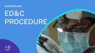 EDampC Procedure Overview Dermatology [upl. by Heyes265]