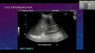 Ecografia Renal y vias Urinarias [upl. by Bartholomeus]