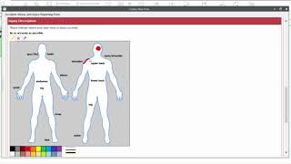 Demo of Hyland OnBase Unity Forms [upl. by Zsa Zsa]