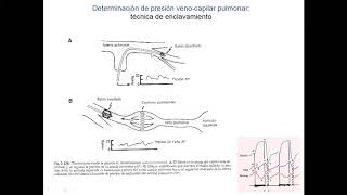 Circulación Pulmonar y Relación VentilaciónPerfusión Parte 1 [upl. by Kronick142]