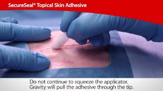 SecureSeal® Topical Skin Adhesive  Cardinal Health [upl. by Trask]