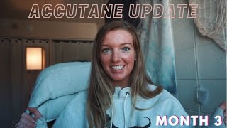 ACCUTANE MONTH 3 UPDATE how long does the purging phase last amp when will Accutane start to work [upl. by Hobard]