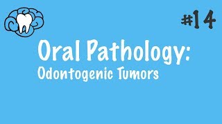 Oral Pathology  Odontogenic Tumors  INBDE ADAT [upl. by Freberg639]