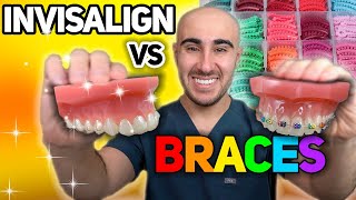 Invisalign Pros and Cons [upl. by Hurlee249]