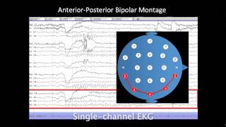 Introduction to EEG [upl. by Werner]