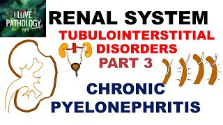 CHRONIC PYELONEPHRITIS  PATHOLOGY [upl. by Uhayile]