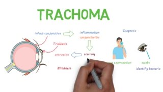 Trachoma  a devastating infectious eye disease [upl. by Einahpats851]