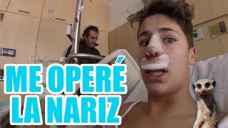 ME OPERÉ LA NARIZ  Juanpa Zurita [upl. by Armallas]