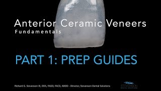 Anterior Ceramic Veneers Part 1 Preparation Guides [upl. by Arotahs]