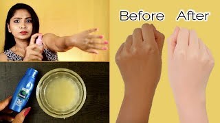 Safe skin lightening creams how to reduce dark spots  best fairness creams  dermatologist [upl. by Nevaed]